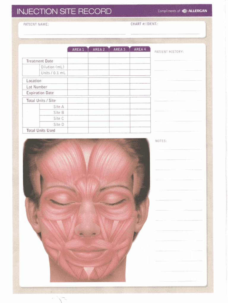 Botox Face Diagram Pdf Fill Out Sign Share Online PdfFiller