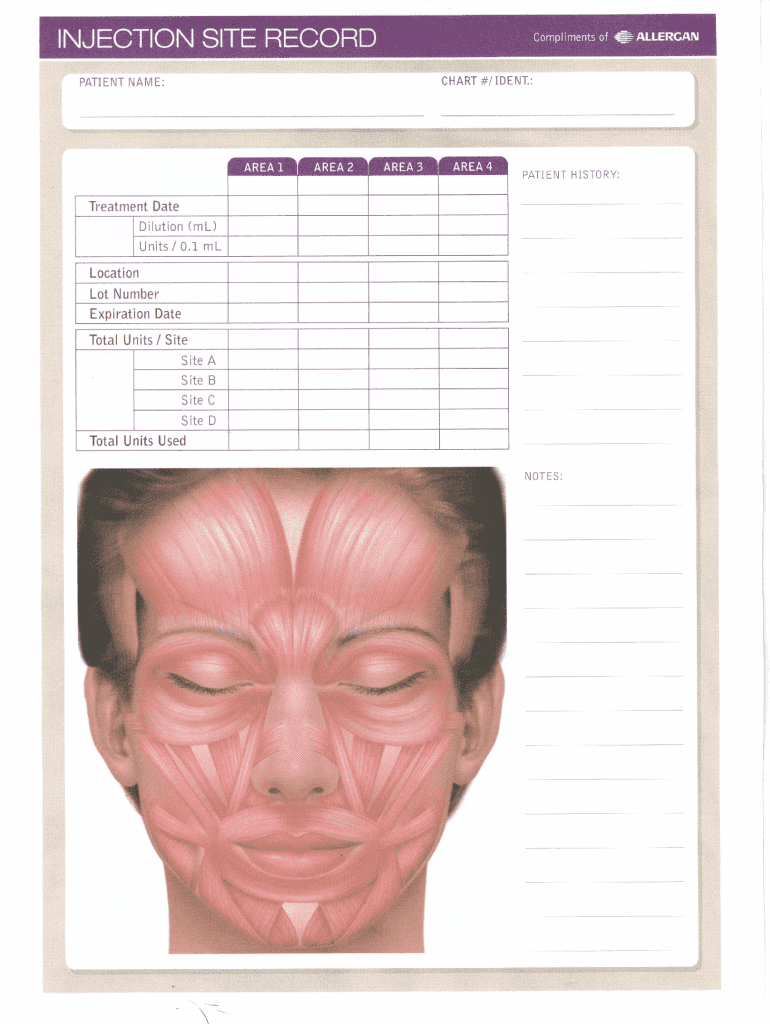 Botox Face Diagram Pdf Fill Out Sign Share Online PdfFiller